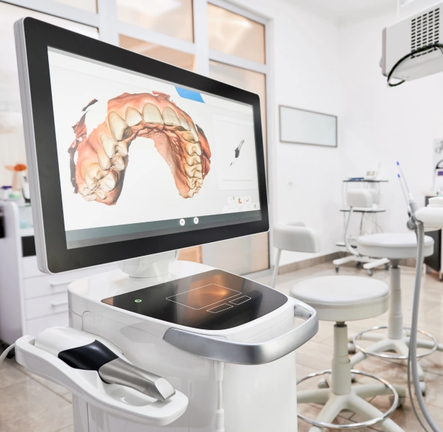 Modern dental office with intraoral scanner displaying 3D tooth model on monitor.